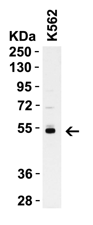 WB Validation in Human K562 Cells
Loading: 15 μg of K562 cell lysate 
Antibodies:  Casp8 A00042-4, 1 μg/mL, 1 h incubation at RT in 5% NFDM/TBST