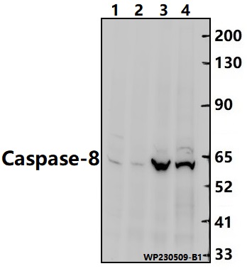 Western blot (WB) analysis of Caspase-8 pAb at 1:2000 dilution
Lane1:PC12 whole cell lysate(30ug)
Lane2:BV2 whole cell lysate(30ug)
Lane3:A549 whole cell lysate(30ug)
Lane4:MCF-7 whole cell lysate(20ug)