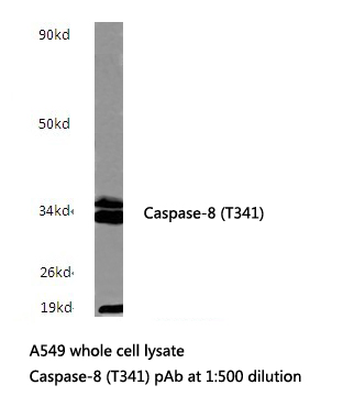 Western blot (WB) analysis of Caspase-8 (T341) polyclonal antibody at 1:500 dilution
Lane1:sp2/0 cell lysate treated with colchicine(0