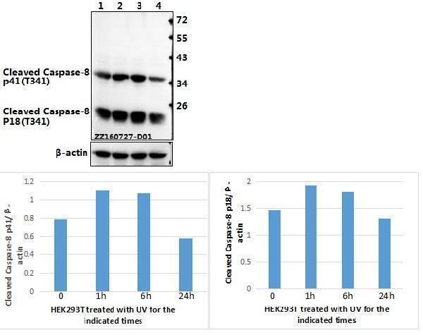 Western blot (WB) analysis of p-Caspase-8 (T341) polyclonal antibody at 1:500 dilution
Lane1:HEK293T whole cell lysate(40ug)
Lane2:HEK293T treated with UV for 1h whole cell lysate(40ug)
Lane3:HEK293T treated with UV for 6h whole cell lysate(40ug)
Lane4:HEK293T treated with UV for 24h whole cell lysate(40ug)