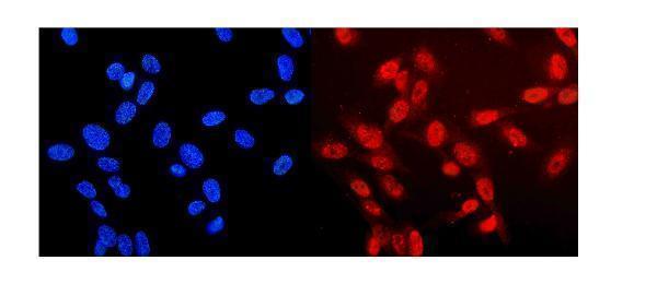 a00043 1 nf1 primary antibodies if testing 7