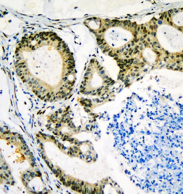 a00043 1 nf1 primary antibodies ihc testing 3_1