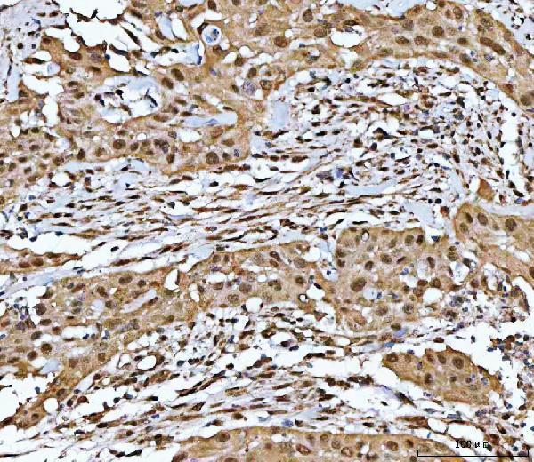 a00043 1 nf1 primary antibodies ihc testing 4
