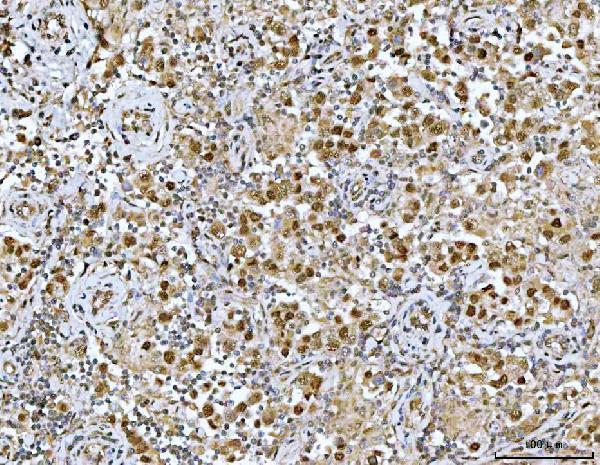 a00043 1 nf1 primary antibodies ihc testing 6