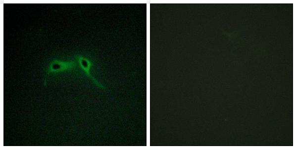 a00043 nf1 primary antibodies if testing 1