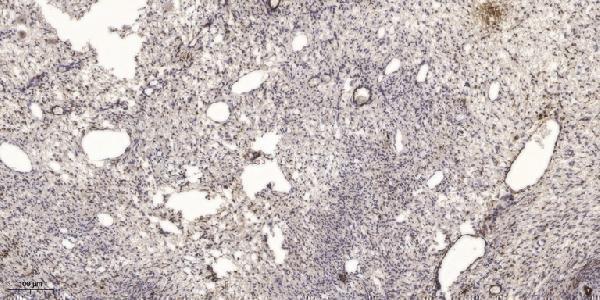 a00043 nf1 primary antibodies ihc testing 5