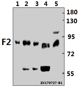 a00044 2 f2 primary antiboties wb testing 1