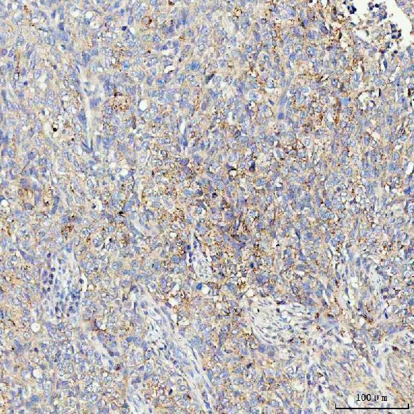  IHC analysis of KRAS using anti-KRAS antibody (A00046-2)