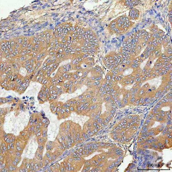  IHC analysis of KRAS using anti-KRAS antibody (A00046-2)