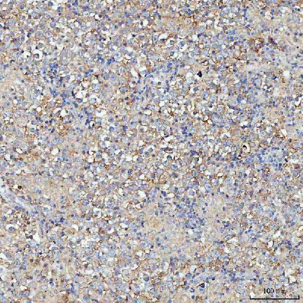 a00046 2 kras primary antibodies ihc testing 4
