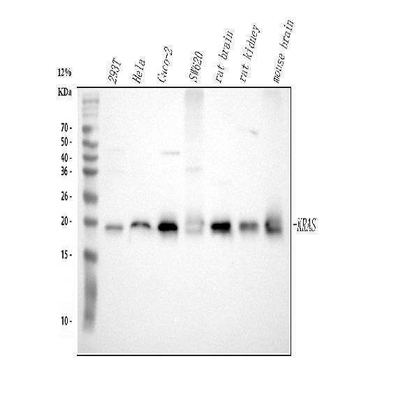  Western blot analysis of KRAS using anti-KRAS antibody (A00046-2)