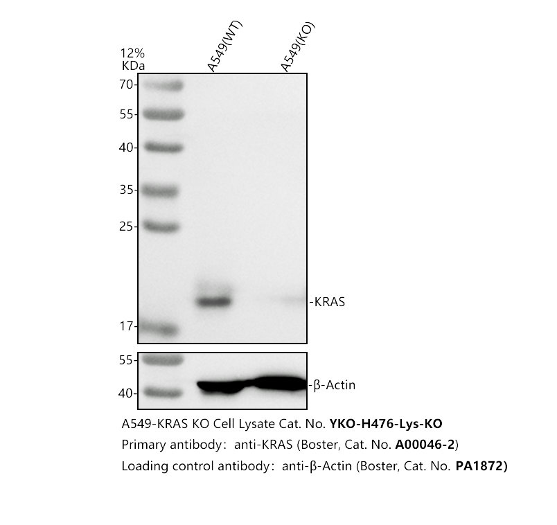 Western blot analysis of KRAS using anti-KRAS antibody (A00046-2)