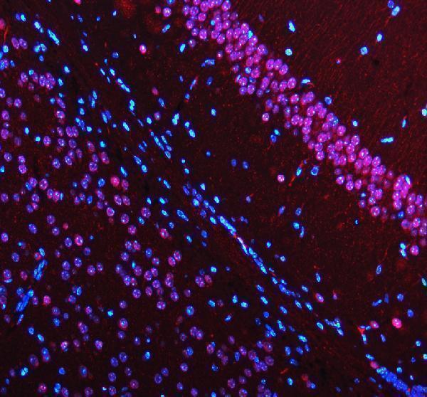 a00047 1 mecp2 primary antibodies if testing 1