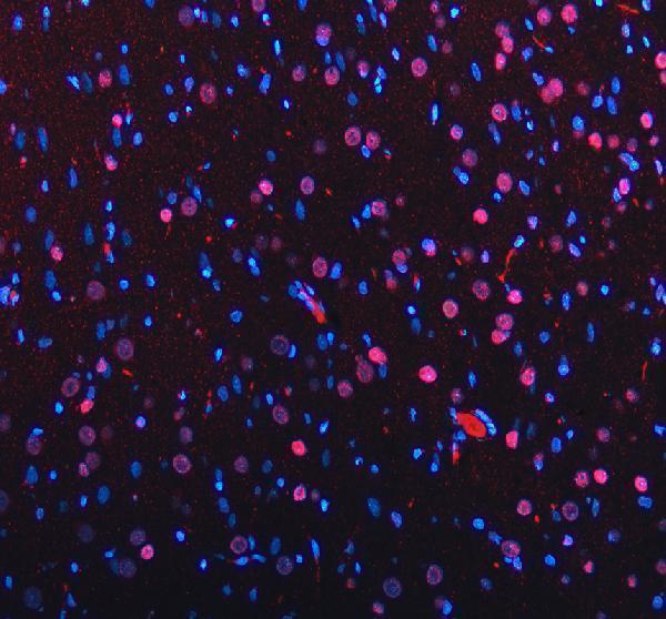 a00047 1 mecp2 primary antibodies if testing 2