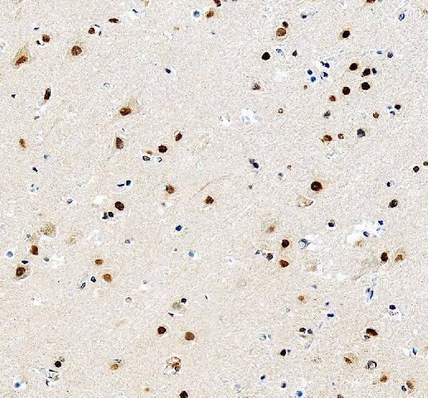 a00047 1 mecp2 primary antibodies ihc testing 1