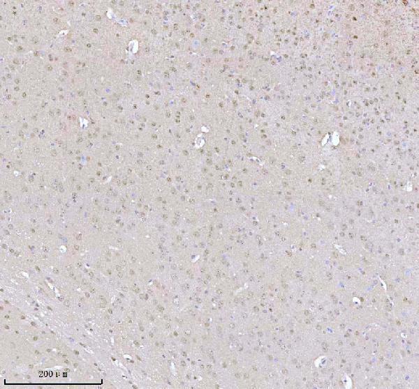 a00047 1 mecp2 primary antibodies ihc testing 2