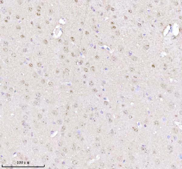 a00047 1 mecp2 primary antibodies ihc testing 3