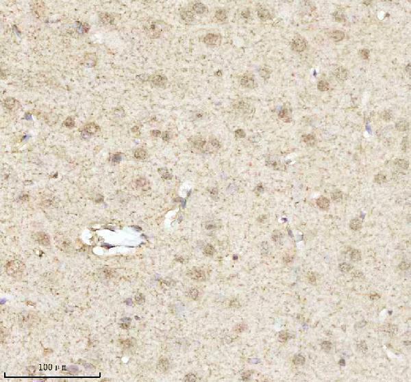 a00047 1 mecp2 primary antibodies ihc testing 5