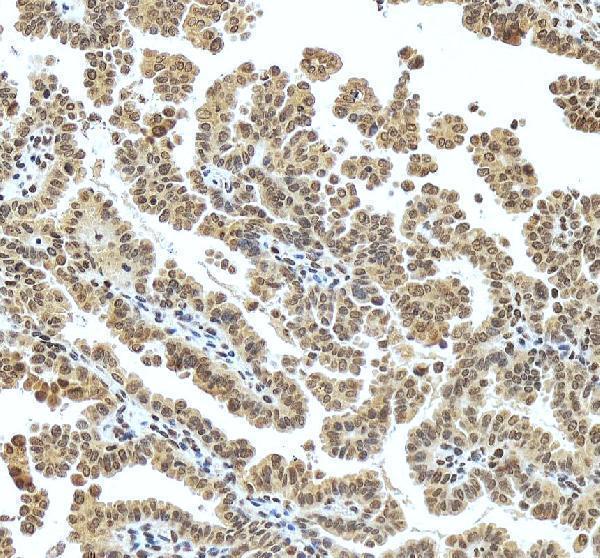a00047 1 mecp2 primary antibodies ihc testing 6