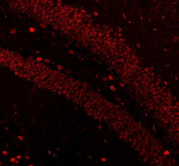 a00047 mecp2 primary antibodies if testing 2