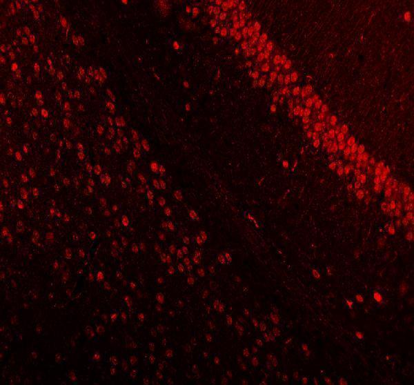 a00047 mecp2 primary antibodies if testing 3