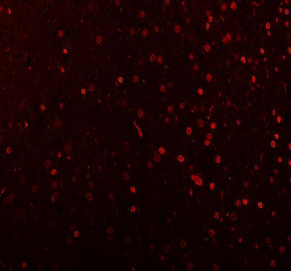 a00047 mecp2 primary antibodies if testing 4