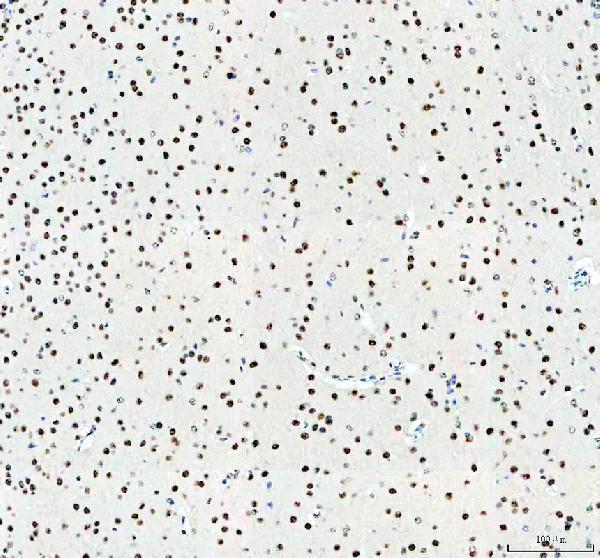 a00047 mecp2 primary antibodies ihc testing 1