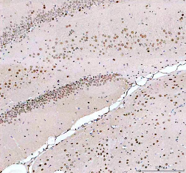 a00047 mecp2 primary antibodies ihc testing 2