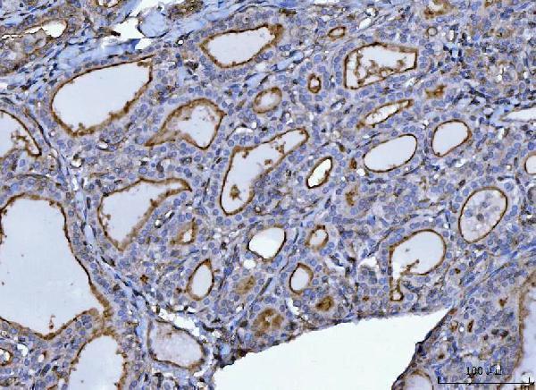  IHC analysis of P Glycoprotein/ABCB1 using anti-P Glycoprotein/ABCB1 antibody (A00049-5)