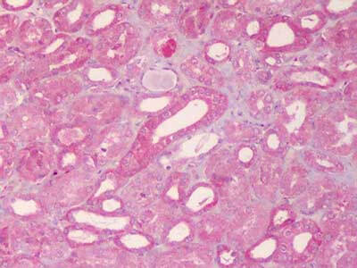 IHC using Boster ABCB1 Antibody at 20 ug/ml against FFPE human kidney