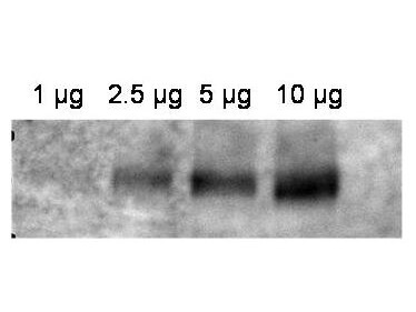 Western blot using Boster
