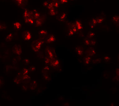 Immunofluorescence of EZH2 in 293 cells with EZH2 antibody at 20 μg/mL