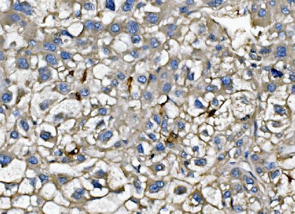 a00053 2 cxcl12 primary antibodies ihc testing 3