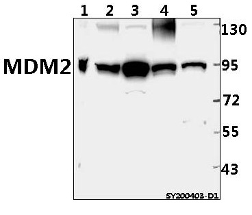 Western blot (WB) analysis of MDM2 pAb at 1:500 dilution
Lane1:HEK293T whole cell lysate(40ug)
Lane2:A549 whole cell lysate(40ug)
Lane3:HCT116 whole cell lysate(40ug)
Lane4:HepG2 whole cell lysate(40ug)
Lane5:Pancl whole cell lysate(40ug)