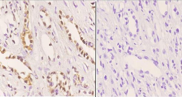 a00054s160 mdm2 primary antiboties ihc testing 4