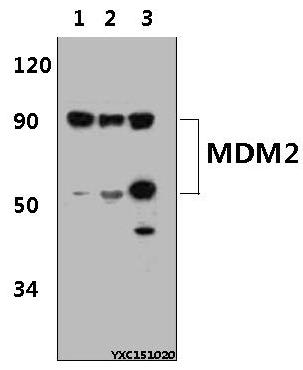 Western blot (WB) analysis of MDM2 (S160) polyclonal antibody at 1:500 dillution
Lane1:HeLa whole cell lysate(30μg)
Lane2:PC12 whole cell lysate(30μg)
Lane3:sp2/0 whole cell lysate(30μg)