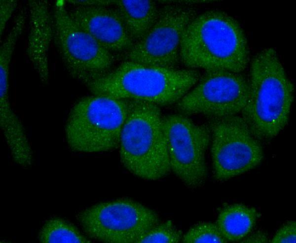 ICC staining Fas in HepG2 cells (green)