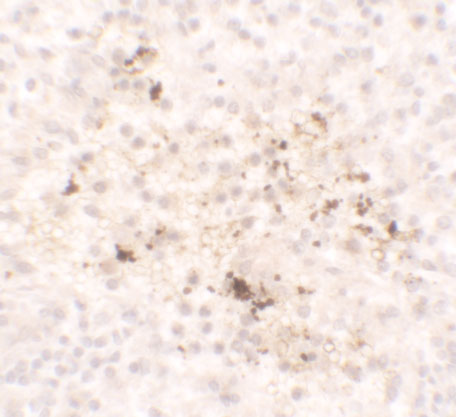 a00056 ccl2 primary antibodies ihc testing 2