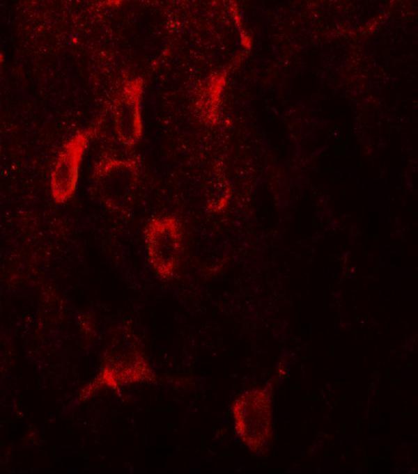 a00057 esr1 primary antibodies if testing 3
