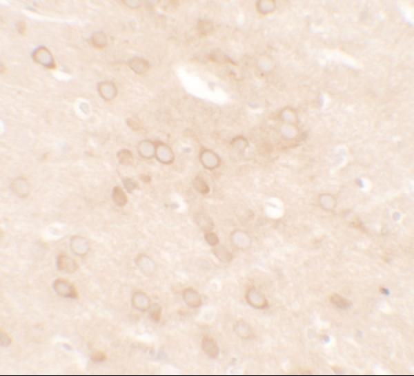a00057 esr1 primary antibodies ihc testing 2