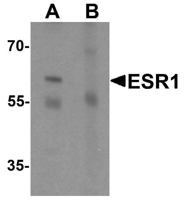 a00057 esr1 primary antibodies wb testing 1