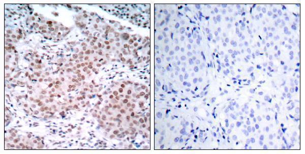 a00057s104 1 esr1 primary antibodies ihc testing 1