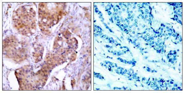 a00057s106 1 esr1 primary antibodies ihc testing 1