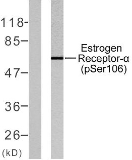 a00057s106 1 esr1 primary antibodies wb testing 3