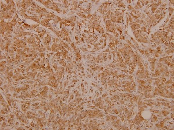 a00057s106 esr1 primary antiboties ihc testing 2