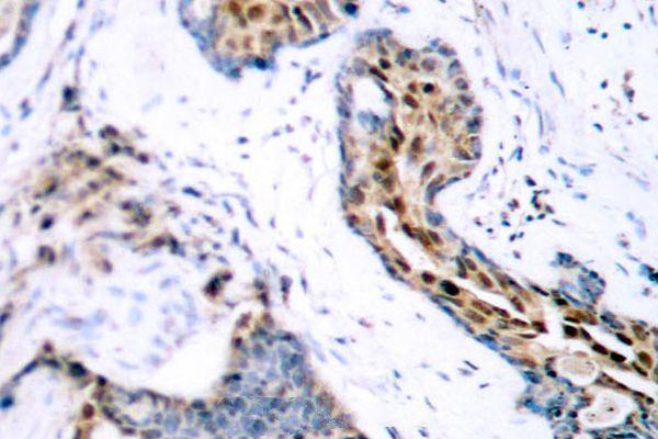 a00057s118 1 esr1 primary antiboties ihc testing 2