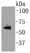 a00057s118 2 esr1 primary antiboties wb testing 1