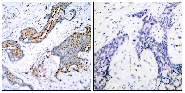 a00057s118 3 esr1 primary antibodies ihc testing 1