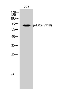 a00057s118 3 esr1 primary antibodies wb testing 2