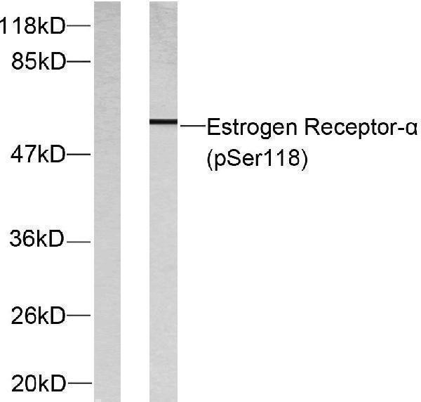 a00057s118 3 esr1 primary antibodies wb testing 3